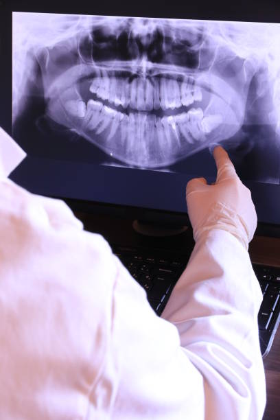 Best Emergency Dental Extractions in Eastpointe, MI